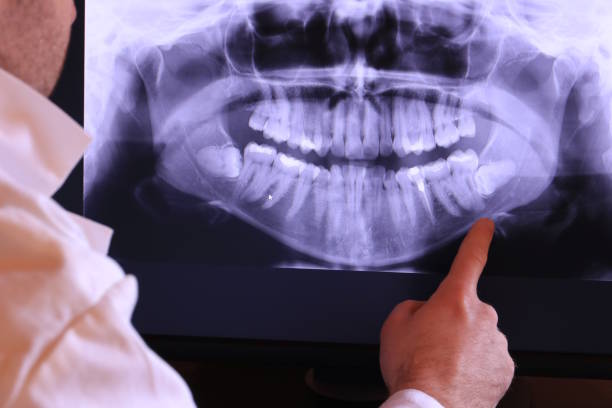 Best Urgent Care for Lost Fillings or Crowns in Gambier, OH