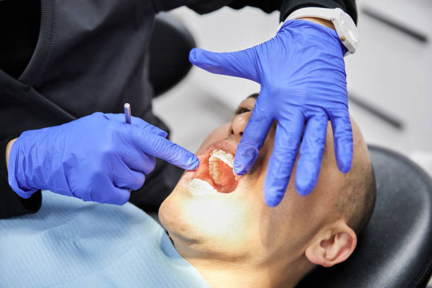 Best Emergency Treatment for Dental Infections or Abscesses in Gambier, OH